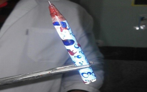 فرو رفتن مداد در سر دانش‌آموز کرمانی!