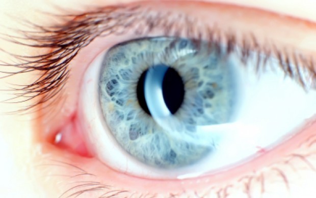 درمورد حساسیتهای چشمی چه میدانید؟