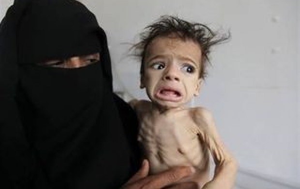 گزارش سازمان ملل از قحطی در یمن