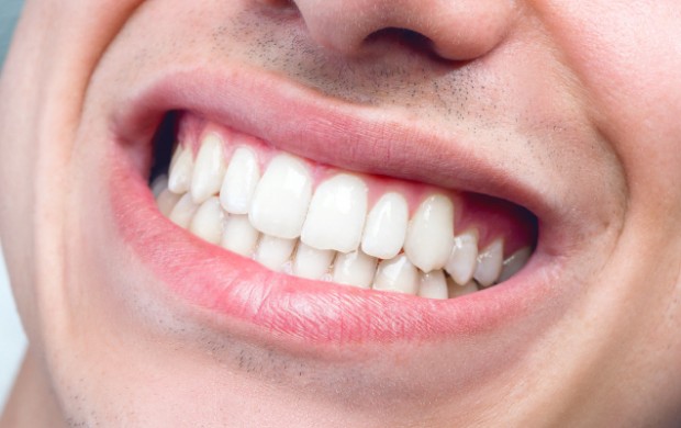غلط جویدن سبب تخریب تاج دندان می‌شود