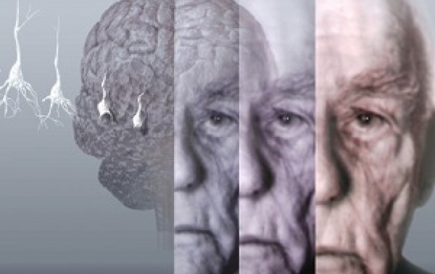 روش‌های بدیع درمان آلزایمر/ شبیخون به بیماری