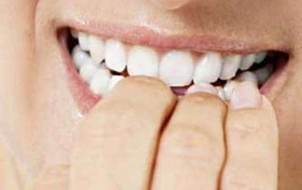 خطرات استفاده از میخک برای تسکین دندان درد