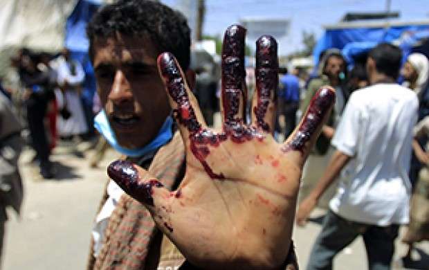مرگ کودکان یمنی زیرسایه سکوت جامعه جهانی