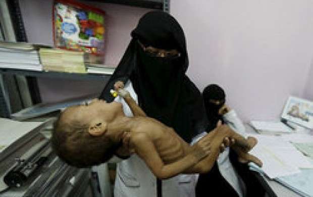 یونیسف: هر ۱۰ دقیقه یک کودک در یمن می‌میرد
