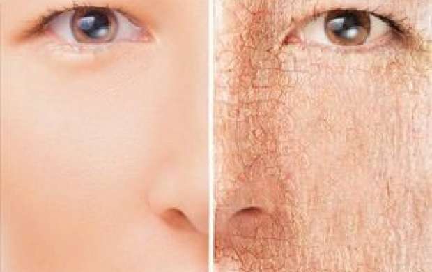 روش‌های درمان خشکی پوست