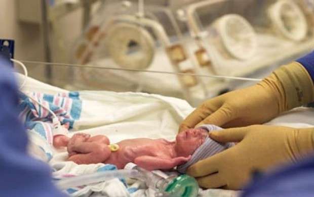 زنده شدن نوزاد که پزشکان مرگش رااعلام کرده بودند