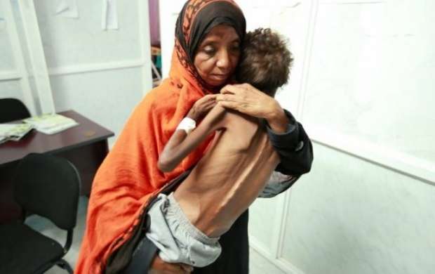 وضع فاجعه‌بار انسانی، مردم یمن را به زانو درآورد