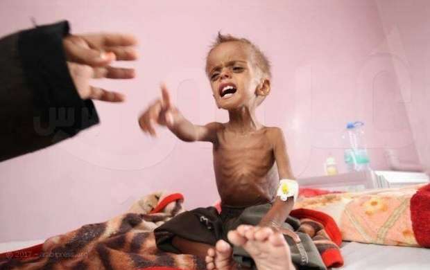 خادمین حرمین با مردم یمن چه کردند؟