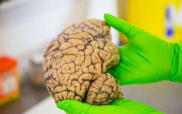 شش توصیه برای بهبود و جلوگیری از آسیب به مغز
