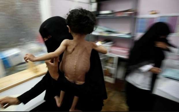 کمبود شدید دارو در استان صنعاء یمن