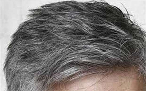 کشف علت سفید شدن موی سر