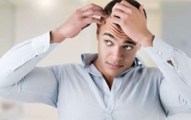 ۵ بیماری که باعث ریزش موها می‌شود
