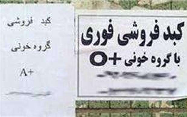 ماجرای فروش کبد ۵۰۰ میلیونی در تهران