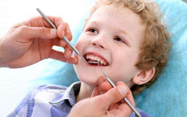 کودکان ایرانی حداقل ۵ تا ۶ دندان پوسیده دارند