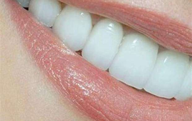 مواد خوراکی مفید برای داشتن دندان‌های سالم