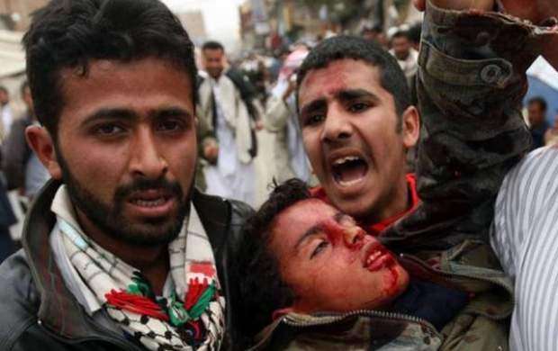 جنایت هولناک نظامیان آل سعود در یمن ۱۸+