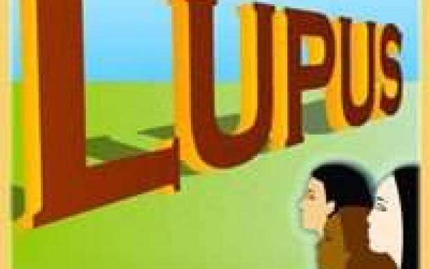 "لوپوس"؛ بیماری خود ایمنی و شایع در زنان