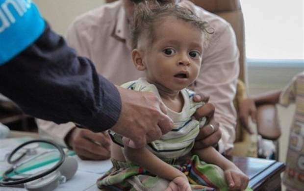هشدار درباره مرگ نیم میلیون کودک یمنی