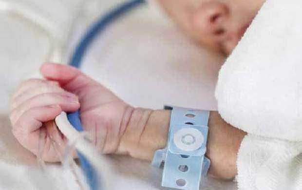 شکافتن پیشانی نوزاد نجف‌آبادی با تیغ جراحی