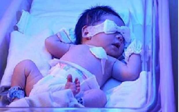 تشخیص زردی نوزادان در کمتر از ۱۰ دقیقه