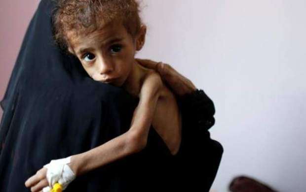 بیش از نیمی از جمعیت یمن در معرض مرگ هستند