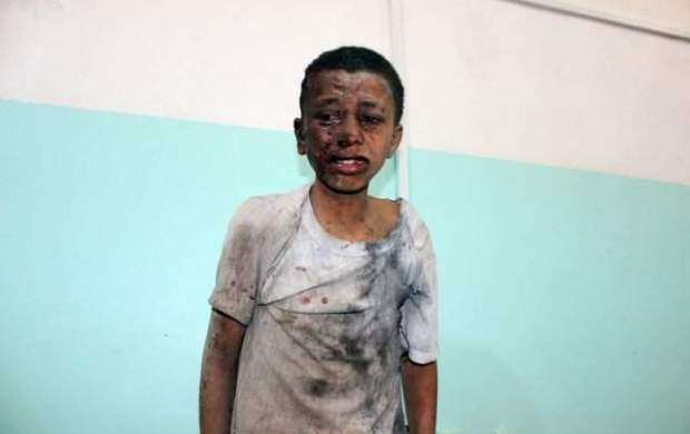 دستان لندن به خون یمنی‌ها آغشته است