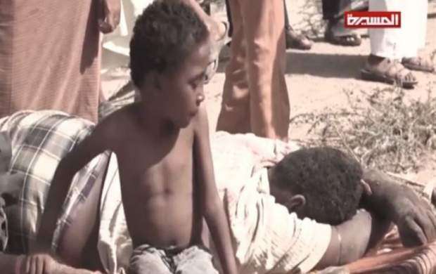 در هر ۱۰ دقیقه مرگ یک کودک یمنی