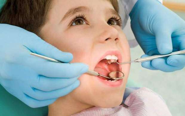 شیوع بالای پوسیدگی دندان در کودکان ایرانی
