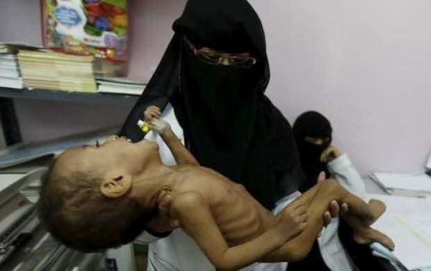 مرگ، گرسنگی بر زندگی یمنی‌ها خیمه زده