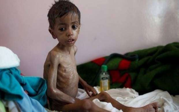۲۲ میلیون نفر در یمن به غذا دسترسی ندارند