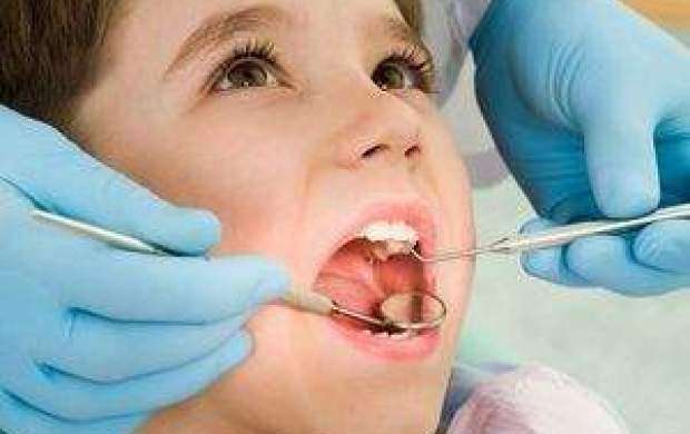 علت افزایش پوسیدگی‌ دندان ایرانی‌ها