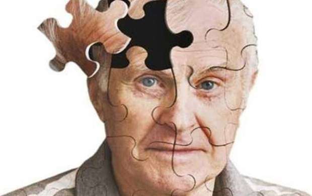 درمان پارکینسون و آلزایمر با تکنولوژی تحریکات مغزی