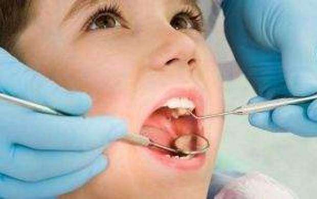 مواد خوراکی مضر برای دندان ها را بشناسید