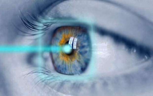 خطرات احتمالی لیزیک چشم چیست؟