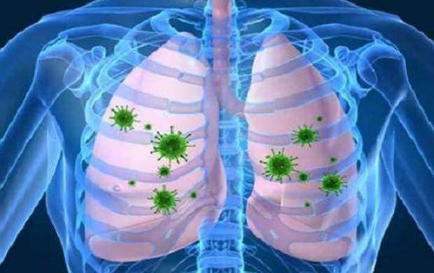 راه‌های پیشگیری از عفونت های تنفسی