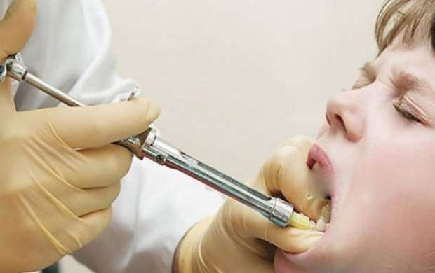 قیمت «کارپول» دندان پزشکان را بی‌حس کرد