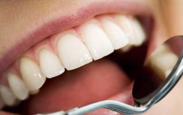 راهکارهای خانگی برای درمان حساسیت دندان