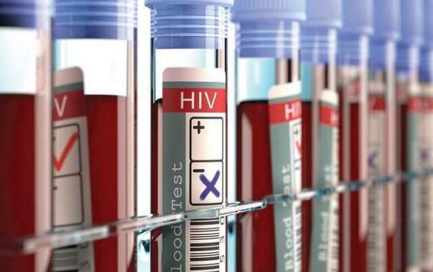 آخرین وضعیت آماری مبتلایان به ایدز