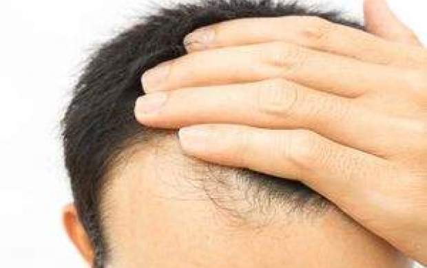 دمنوش مفید برای درمان ریزش مو کدام است؟