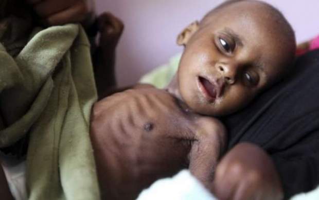 هر دو ساعت یک مادر و ۶ نوزاد در یمن می‌میرند