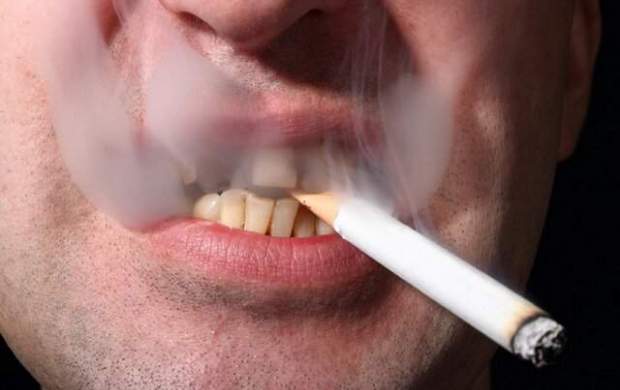 دخانیات و الکل از علل اصلی سرطان‌های دهان
