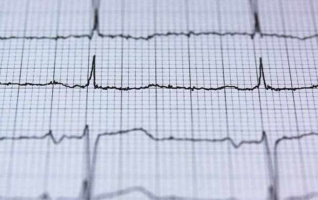 ردیابی افراد با ضربان قلب توسط پنتاگون