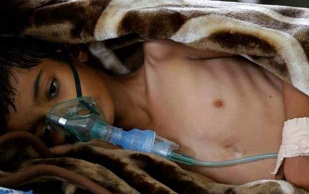 افزایش ۹ برابری مرگ و میر ناشی از وبا در یمن