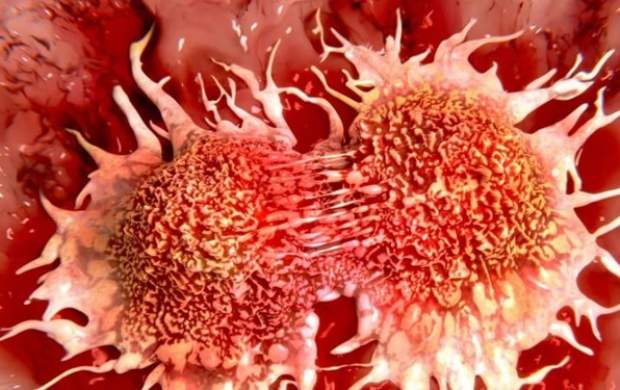 چه چیزی باعث بروز سرطان سینه می‌شود؟