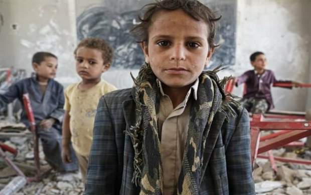 افزایش شمار کودکان یمنی مبتلا به سرطان