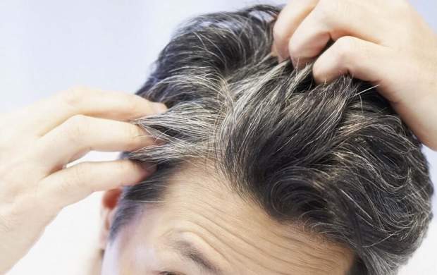 استرس باعث خاکستری شدن مو می‌شود