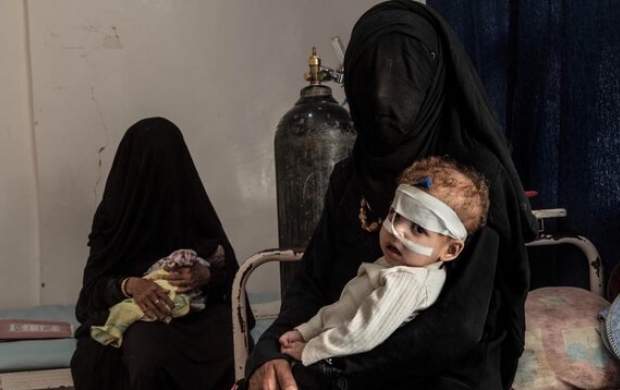سازمان ملل نسبت به اوضاع بهداشتی یمن هشدار داد