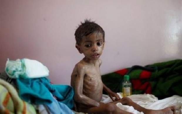 هشدار سازمان ملل درباره خطر قحطی مجدد در یمن