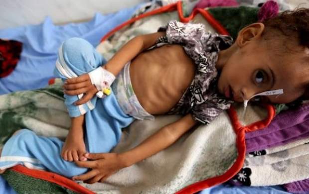 هشدار سازمان ملل از آغاز فاجعه در یمن