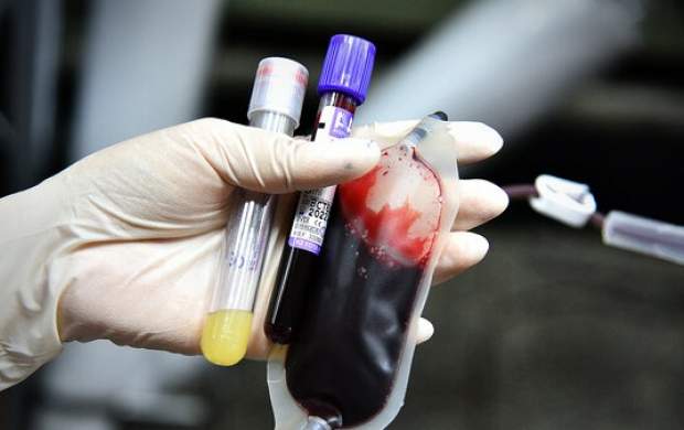 مشکلات اهدای خون در پاندمی کرونا